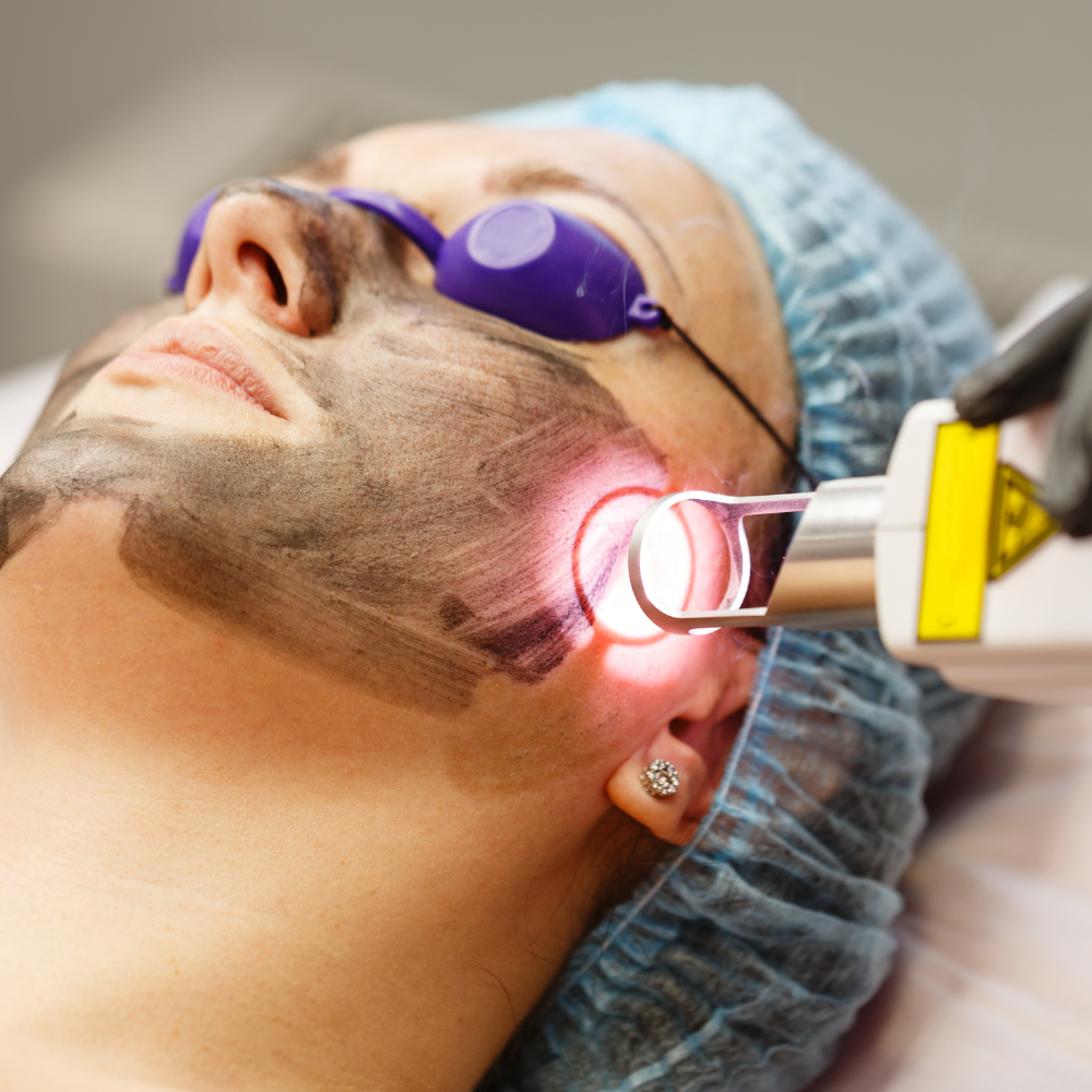 Carbon laser: dagna courtman permanent makeup and beauty