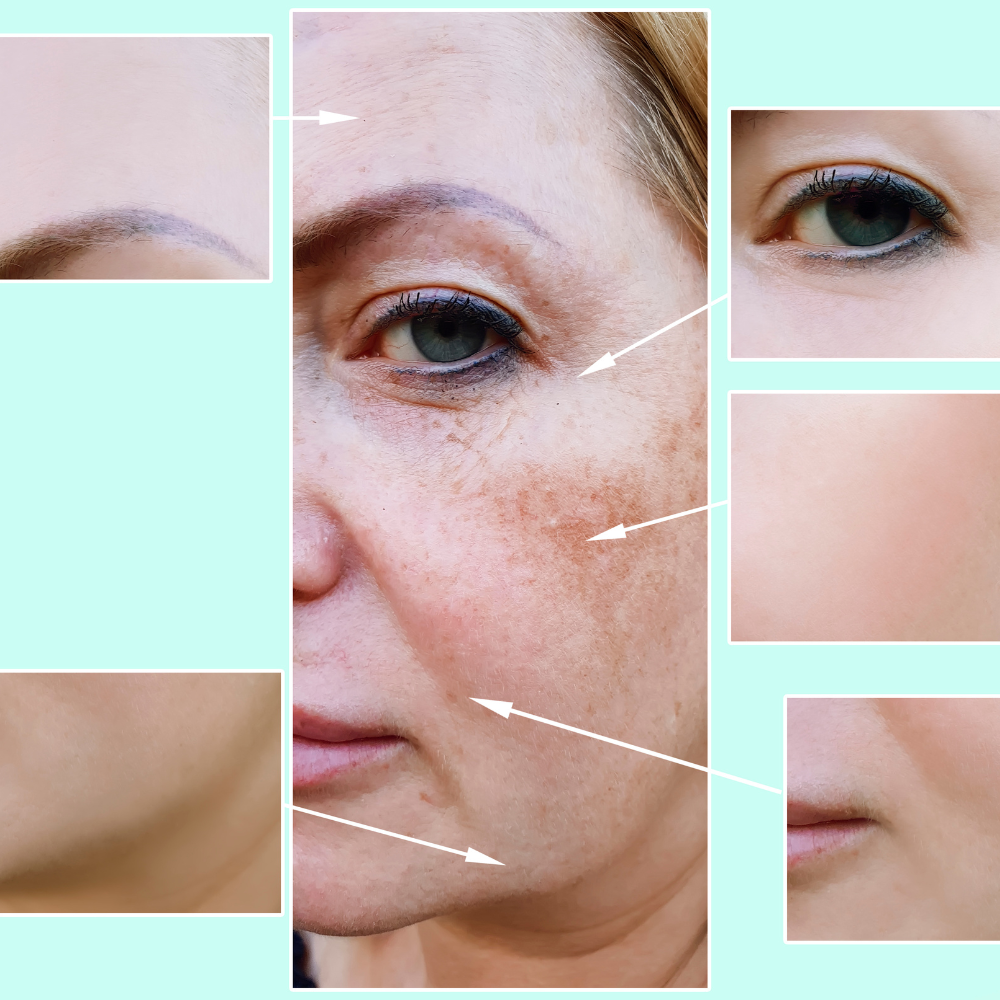 Pigmentation rem: dagna courtman permanent makeup and beauty